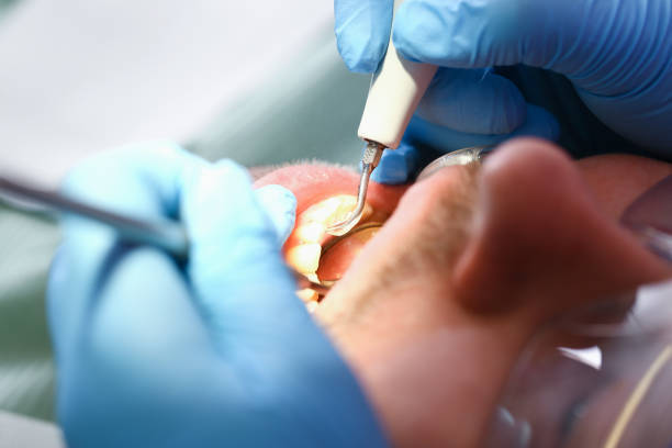 Best After-Hours Emergency Dentist in Tyro, NC